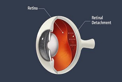 Retina.jpg